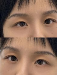 点击看大图 -张小野·专业半永久纹眉