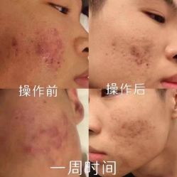 -冰芙洁问题性皮肤美甲美睫