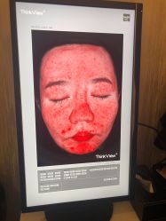 体验前-新美荟医美·专注面部美学抗衰