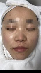 体验前-禾美嘉医疗美容