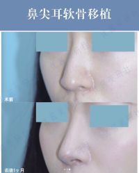 -丽都整形美容医院·全国连锁旗舰店