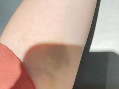 -爱康国宾体检中心(杭州滨江江南大道分院)