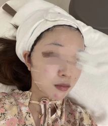 点击看大图 -美安心医美·美迪迈黄金微针·美拉美医疗美容