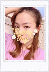 点击看大图 体验后-大麦微针植发全国连锁