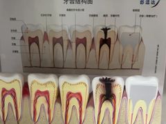 -上海仁爱医院口腔科 · 种植