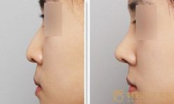-CMS西美斯·美式医疗美容