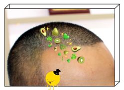 -大麦微针植发全国连锁