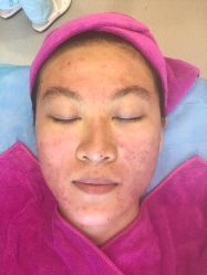 -北京米扬丽格医疗美容·联合丽格鼻整形中心