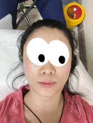 体验前-深圳春天阳光医院·轮廓抗衰中心