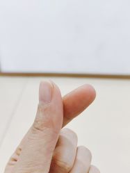 -成都西区医院整形美容
