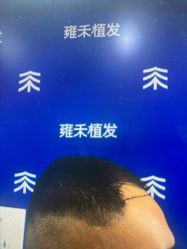 -雍禾植发全国连锁