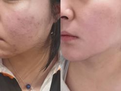 -素妍印象Ekrin Medi Clinic