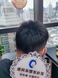 -唐风采假发补发定制