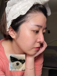 体验后-VE专注问题肌·赛诺龙&科学美肤中心