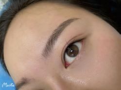 点击看大图 体验后-重庆联合丽格第五医疗美容医院