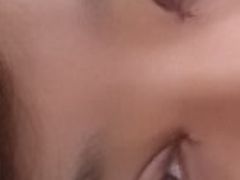 第一天-上海华安整形外科门诊部