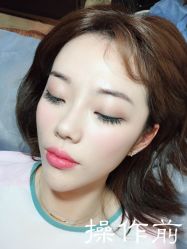 点击看大图 -西施无菌半永久纹绣眉眼影唇轻增发纹发际线