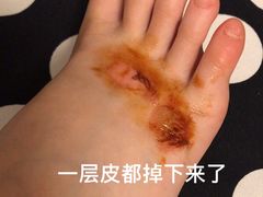 -吴淞炮台湾湿地森林公园烧烤区