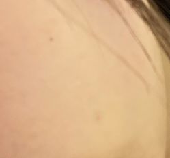 -比华利美容医院