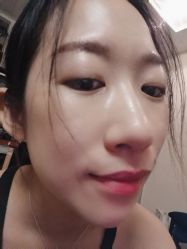 体验后-JS医疗美容