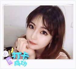 点击看大图 体验后-大麦微针植发全国连锁