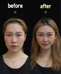 -Dr.U博士医疗美容医院