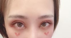 体验后-大华韩艺整形美容医院