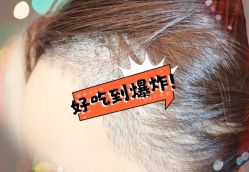 -大麦微针植发全国连锁