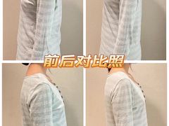 -FACE·日本小颜美容整骨(福田店)