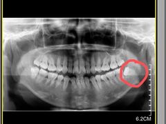 -浙江大学医学院附属口腔医院湖滨（延安）院区