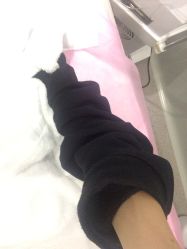 -苑苑vbeauty科技美容SPA