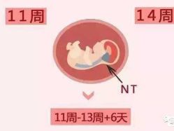 -邢台妇产医院