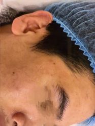 -蕾特恩专业祛痘·皮肤管理