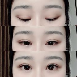 -长沙雅美医疗美容医院