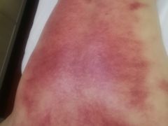 -赵氏盲人按摩(武林门店)