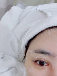 体验后-上海首尔丽格医疗美容医院