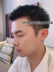 -雍禾植发全国连锁