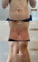 -HYOUNG 禾漾·BTL官方美学中心