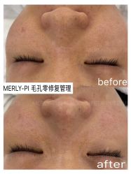 -MLP美丽派·问题肌疗愈中心