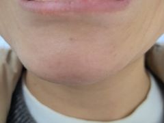 -极光口腔·矫正种植修复(锦江院区)