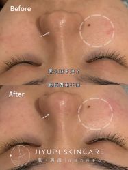 点击看大图 -MLP美丽派·问题肌疗愈中心