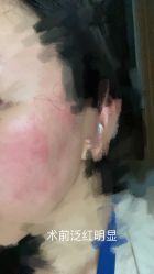 体验前-亚心总医院·皮肤管理