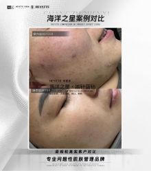 -禾壹净·素颜美问题肌肤修护中心