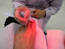 -派恩宜灰指甲鸡眼嵌甲手足癣