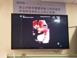 -杭州贝瑞斯美华妇儿医院·早孕·产检·儿科