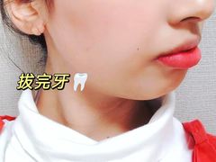 -极光口腔·矫正种植修复(锦江店)