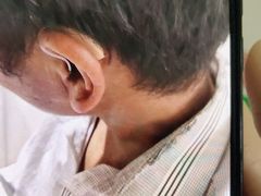 -自然之声助听器·呼吸机(贵定店)