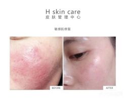 -美壹生诊所皮肤管理中心·海菲秀&Legacy美白舱