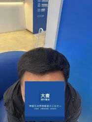 -大麦微针植发全国连锁