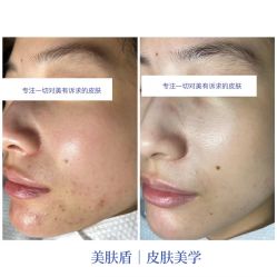 -美肤盾祛痘·问题肌头疗管理中心